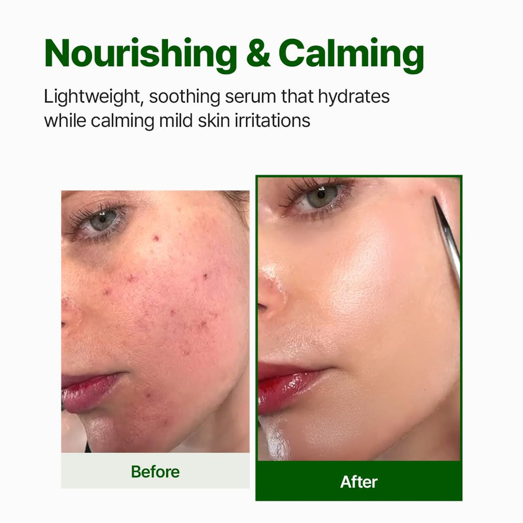 NACIFIC Cica PDRN Centella Serum (Centella Ampoule) 1.69 fl oz / 50ml, Korean Serum for Sensitive Skin, Calming & Hydrating