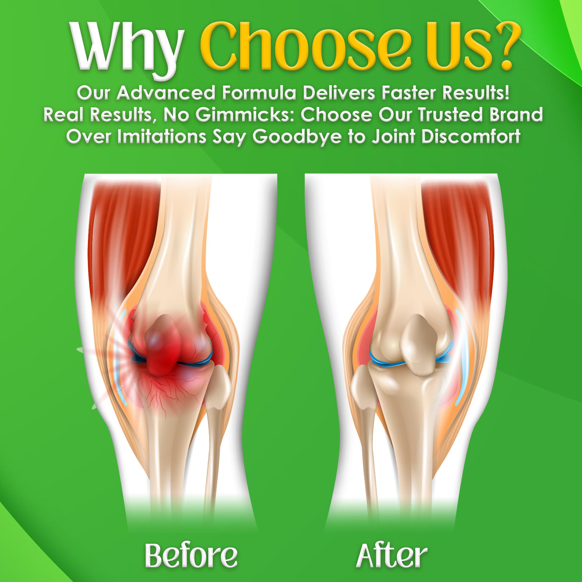 NutriGout Uric Acid Cleanse Supplement w/Turmeric, Celery Seed, Bromelain, Milk Thistle, Dandelion and Chanca Piedra,