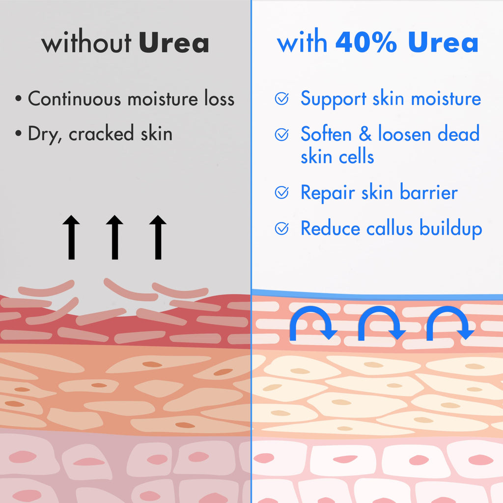 Ebanel Urea Cream 40% plus Salicylic Acid 2%, Foot Cream for Dry Cracked Heels Feet Knees Elbows Hands, Foot Dead Skin Cuticle Callus Remover Toenail Softener, Keratolytic Skin Barrier Repair, 3-Pack