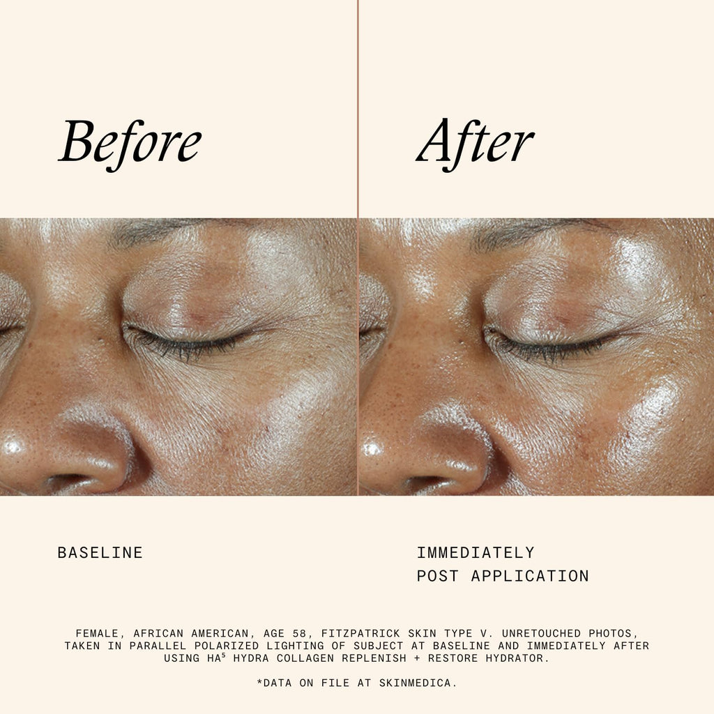 SkinMedica HA5 Hydra Collagen Hydrator with Vegan Collagen (NEW PACKAGING), Age-Defying Skincare for Women with Hyaluronic Acid