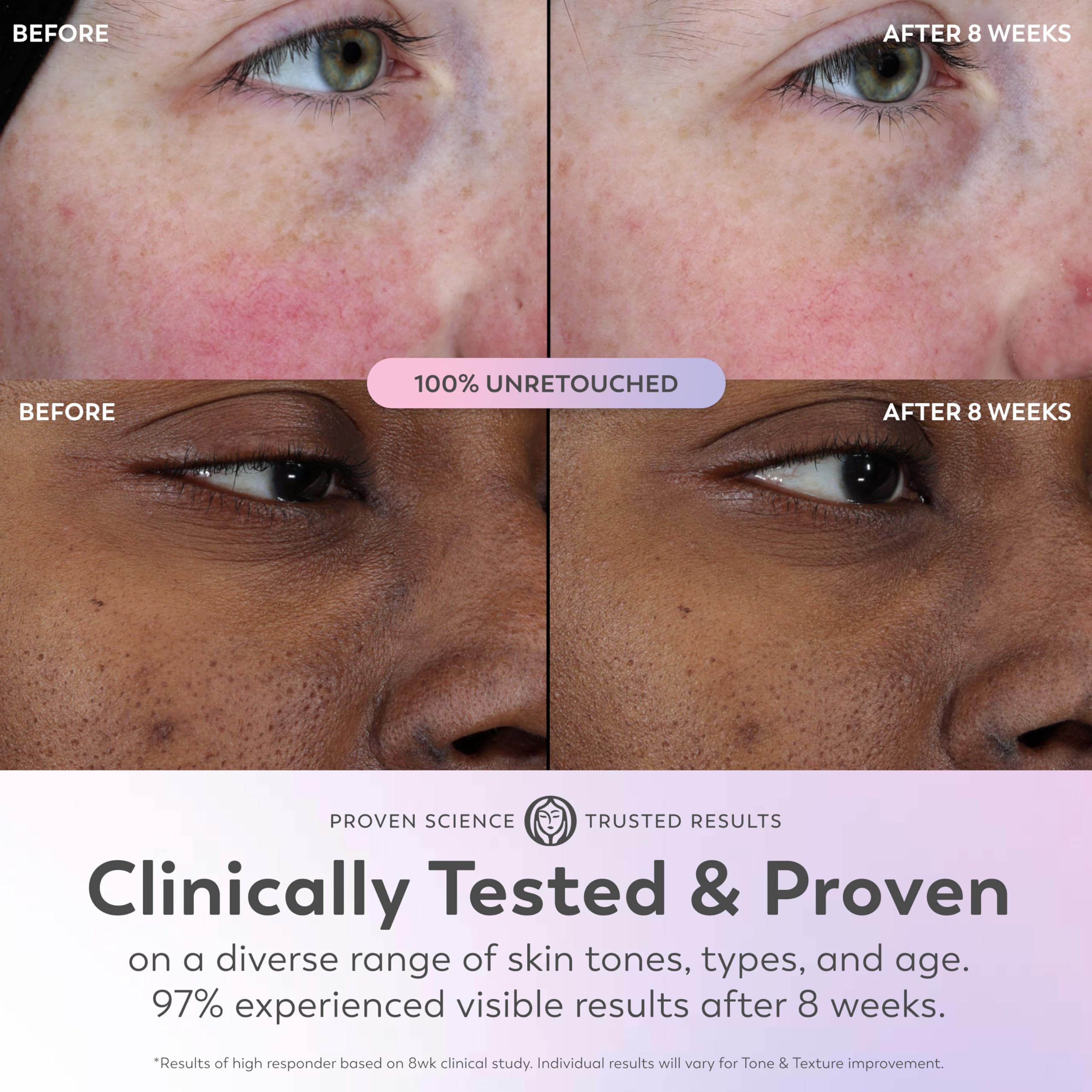 Olay Super Serum - Glow Serum for Face - Activated Niacinamide, Vitamin C & E, Collagen Peptide, AHA - 5-in-1 Benefits - Brightens, Hydrates, Smooths,