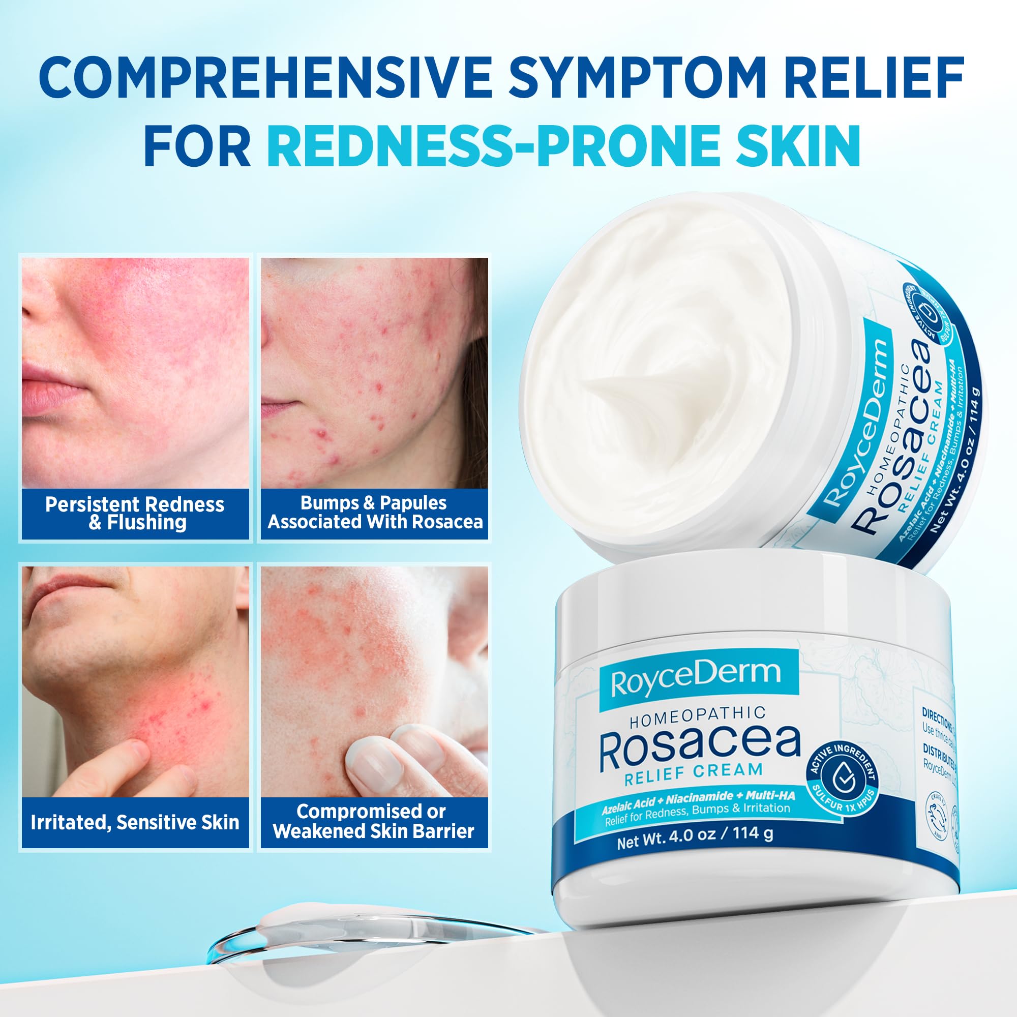 Roycederm Rosacea Treatment for Face with Azelaic Acid – Redness Relief & Corrector – Sensitive Skin Moisturizer for Redness, Bumps & Irritation