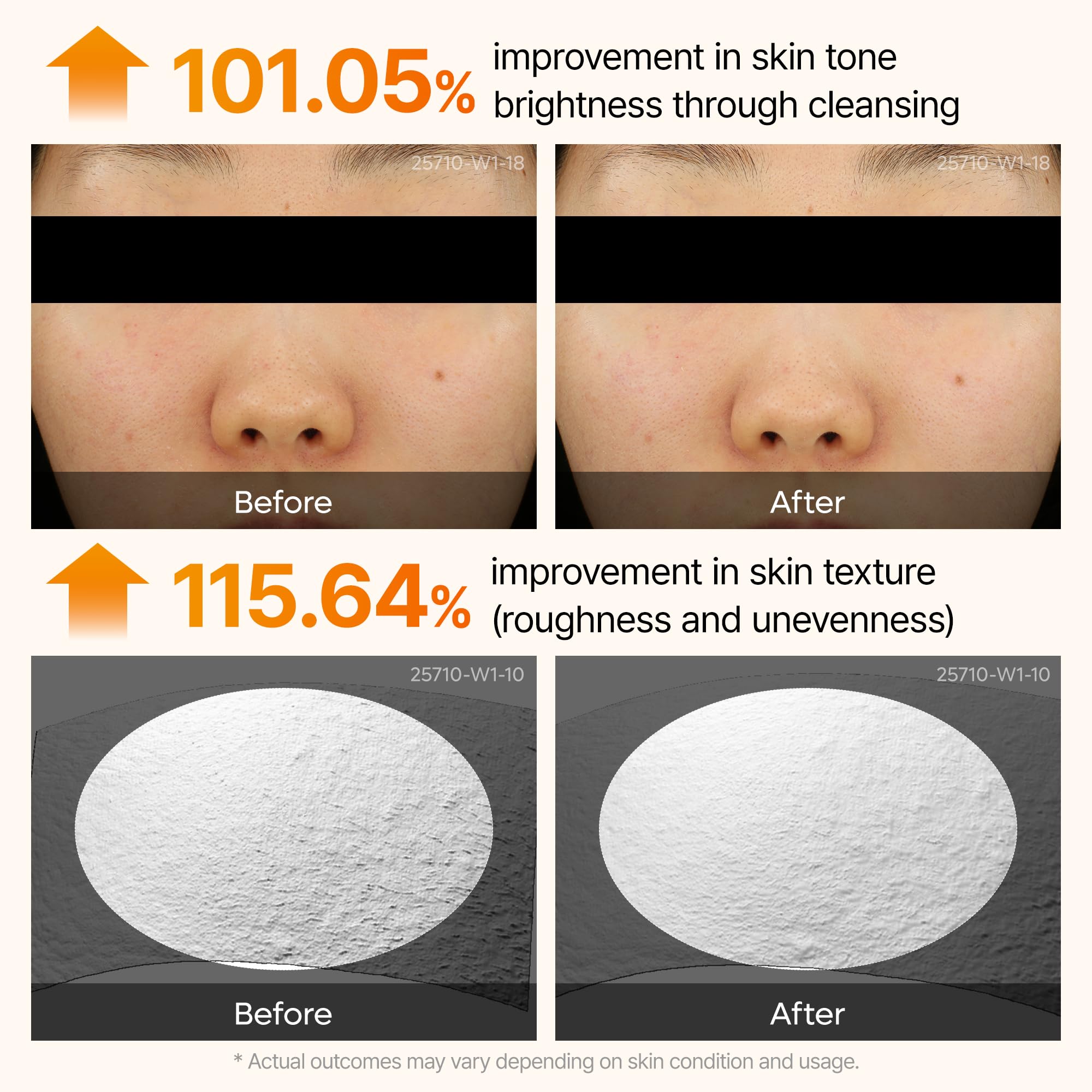 Dr. Melaxin Peel Shot Kojic Acid Turmeric Serum – Exfoliating Dark Spot Corrector with AHA/BHA & Niacinamide, Brightening & Even Tone